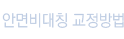 안면비대칭 교정방법